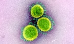 Coronavirus: parámetros que indican un pronóstico grave del Covid-19