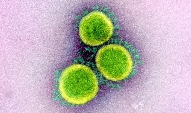 Coronavirus: parámetros que indican un pronóstico grave del Covid-19