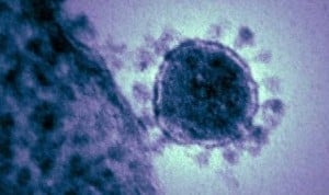 Coronavirus síntomas: conjuntivitis, otro factor asociado al Covid-19