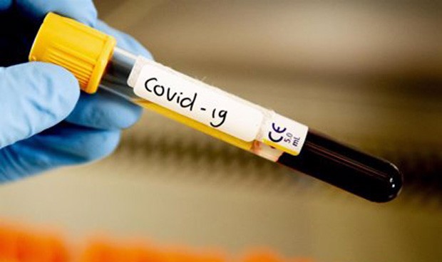 Coronavirus: altos niveles de vitamina D reducen su gravedad y mortalidad