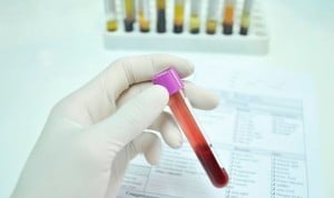Un análisis de sangre predice complicaciones graves en pacientes Covid