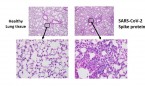 La proteína pico del SARS-CoV-2 tiene potencial para causar daño pulmonar