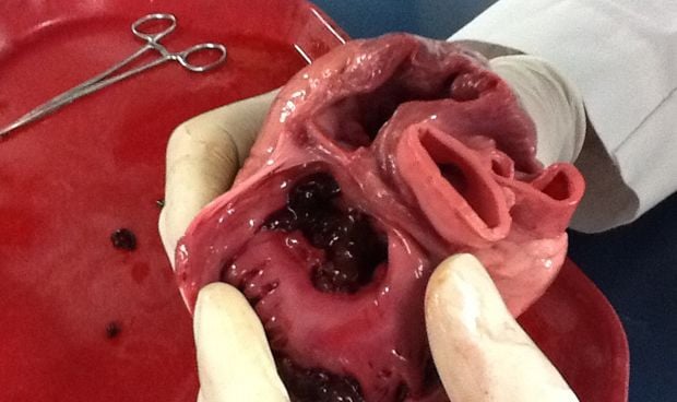Crean modelos de vlvulas cardiacas en 3D para sustituir a las reales