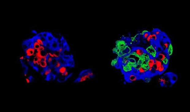 Crean 'superinjertos' para mejorar el tratamiento de la diabetes tipo 1