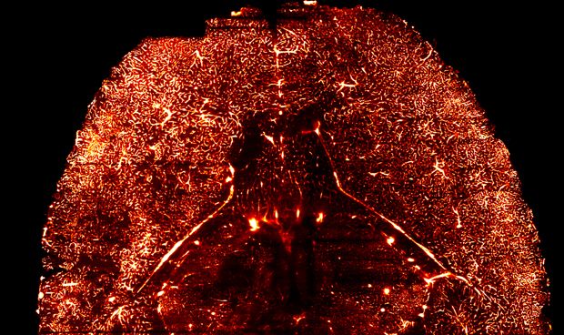 Crean un atlas molecular de los vasos sangu�neos del cerebro
