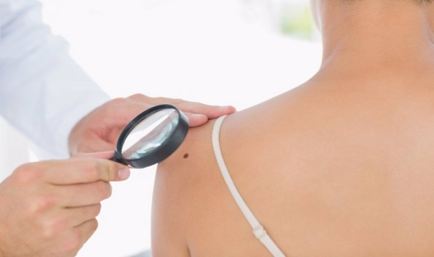 Crean una prueba que predice de forma fiable la propagación del melanoma