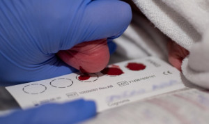 El cribado neonatal no es un lujo; una nueva guía técnica da las claves