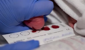 Cribado neonatal.