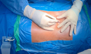 Cristina Aracil, médica, sobre la 'nueva' cirugía de columna: "Menos dolor"