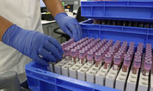 Muestras de Análisis Clínicos.