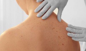 La evaluación dermatológica de cualquier cáncer mejora la calidad de vida