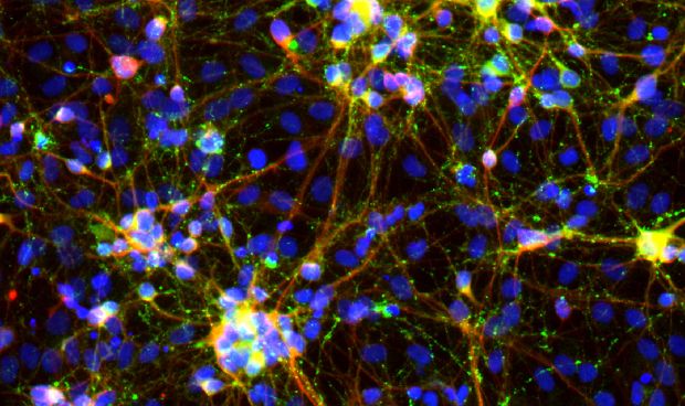 Desarrollan un método para convertir células de la piel en neuronas