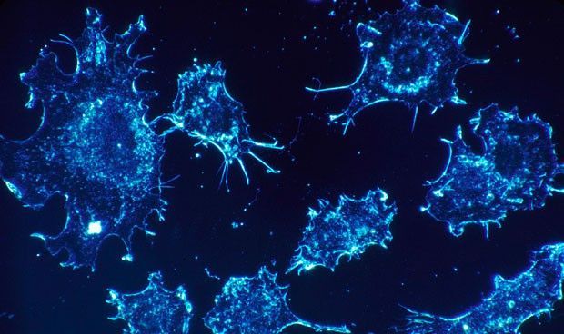 Descubren cmo abrasar clulas cancergenas con nanopartculas