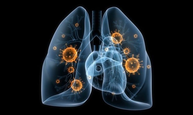 Descubren por qué algunos cánceres de pulmón resisten la quimioterapia