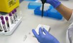 Investigadores descubren un nuevo subtipo de esclerosis m�ltiple