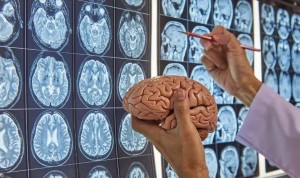 Descubren una red cerebral común para las enfermedades psiquiátricas