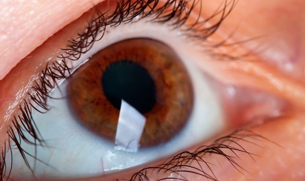 Detectan signos precoces de alzhimer con un anlisis no invasivo del ojo