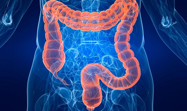 Dos tipos de bacterias intervienen en el cncer de colon hereditario