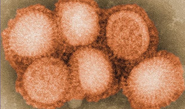 Dos tipos de gripe estacional ejercen como �antesala� del p�rkinson