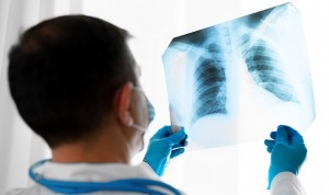 El 62% de los equipos de rayos X de los hospitales españoles está obsoleto