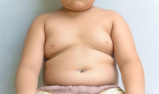 El 70% de los padres no es consciente del sobrepeso de sus hijos