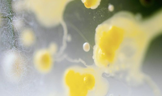 El 90% de casos de infección por C. difficile se curan con trasplante fecal