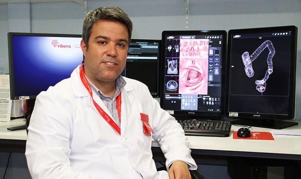 El Anillo Radiológico de Ribera integra ocho hospitales del grupo