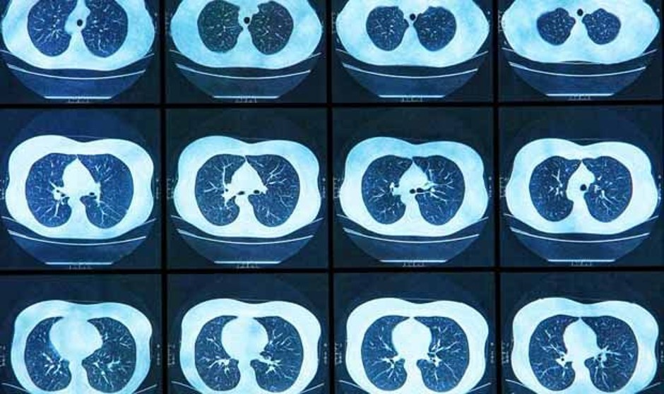 El apoyo de Sanidad al proyecto Cassandra, en 'periodo de reflexión'