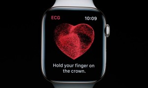 El Apple Watch detecta la fibrilación auricular con una precisión del 84%