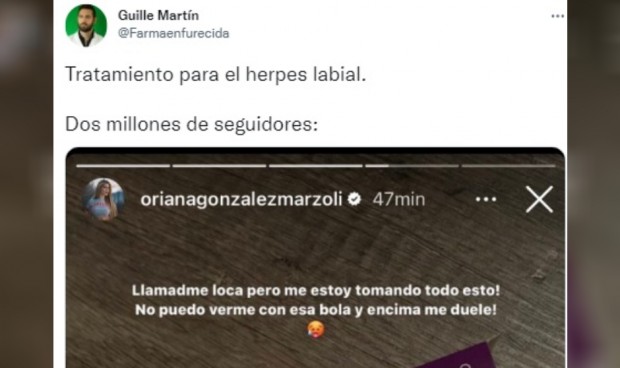 El "atentado contra la salud" de Oriana Marzoli: antibiótico para un herpes