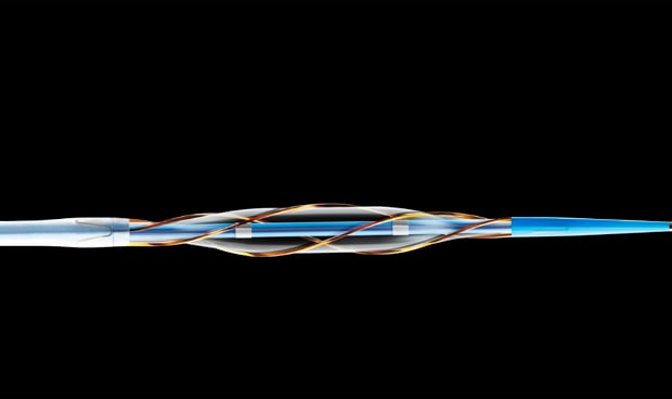 El catéter-balón AngioSculpt, eficaz en restenosis de 'stent'