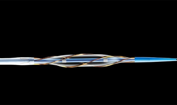 El catéter-balón AngioSculpt, eficaz en restenosis de 'stent'