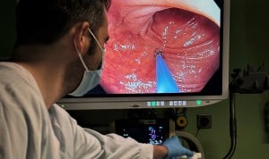El CHUP probará un nuevo sistema de endoscopias con inteligencia artificial