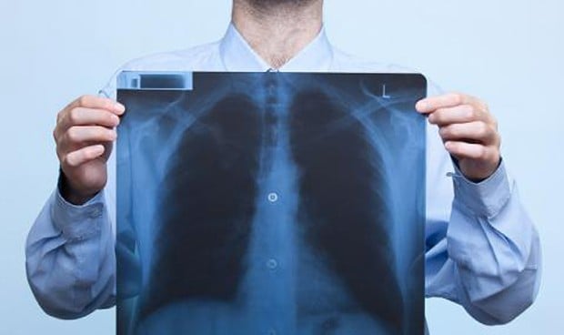 El código TEP reduce la mortalidad en pacientes con tromboembolia pulmonar