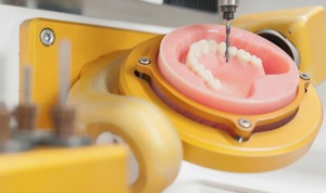 El Consejo Europeo avala el uso de sistemas CAD-CAM en clínicas dentales