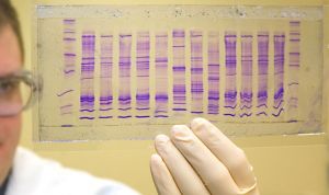 El consejo genético reduce los efectos adversos del tratamiento del TDAH