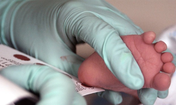 El cribado neonatal de Sacyl incorpora la detección de 4 enfermedades