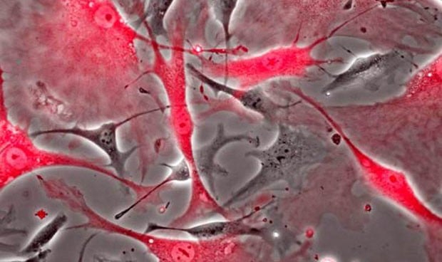 El CSIC describe dónde se encuentran las células madre en el corazón