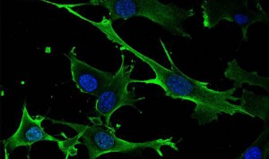 El CSIC descubre un nuevo gen inductor de cáncer en varias células