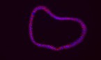 El CSIC identifica nuevos marcadores de riesgo en cáncer de colon 