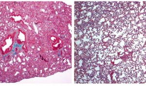 El CSIC muestra que la cortistatina es eficaz para tratar fibrosis pulmonar