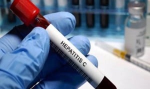El diagnóstico oportunista de la hepatitis C es "clave" para su eliminación