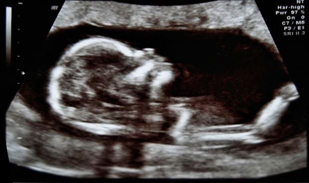 El fluido uterino de la madre, la conexión del feto con el mundo exterior 