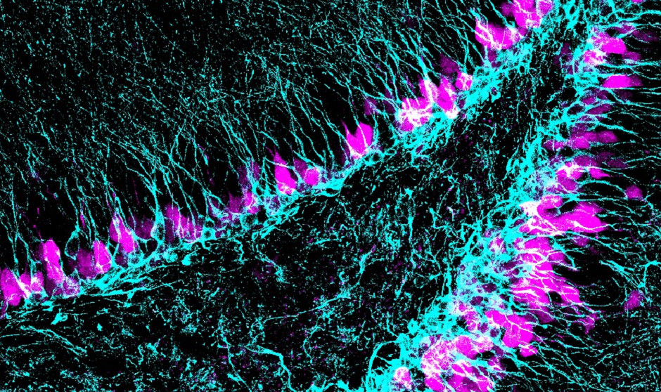 El gen 'guardián' del equilibrio de las células madre en el cerebro