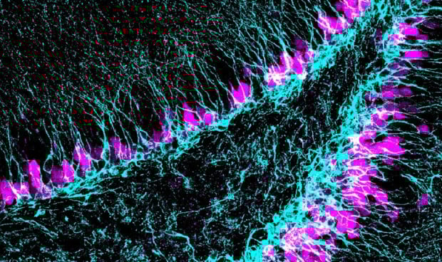 El gen 'guardián' del equilibrio de las células madre en el cerebro