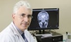 El Gregorio Marañón mejora la función motora de pacientes con párkinson