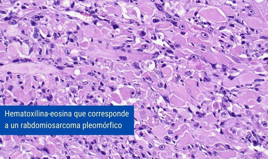 El H. Sant Pau, acreditado para estudiar biopsias de hueso y partes blandas