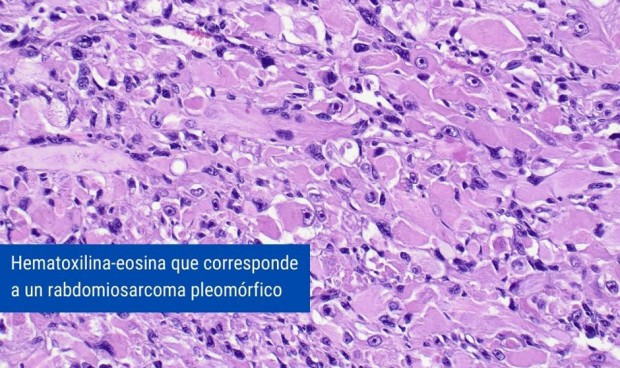 El H. Sant Pau, acreditado para estudiar biopsias de hueso y partes blandas