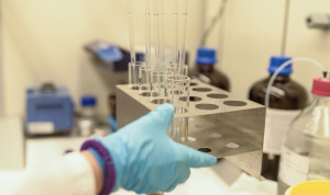 Una secuenciación asegura que el hantavirus tiene poco potencial pandémico