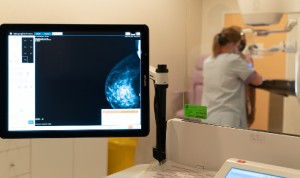 El Hospital de Dénia cuenta con un nuevo mamógrafo con tecnología 3D